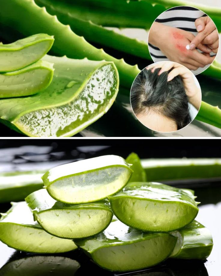 Aloe Vera Scalp Care​