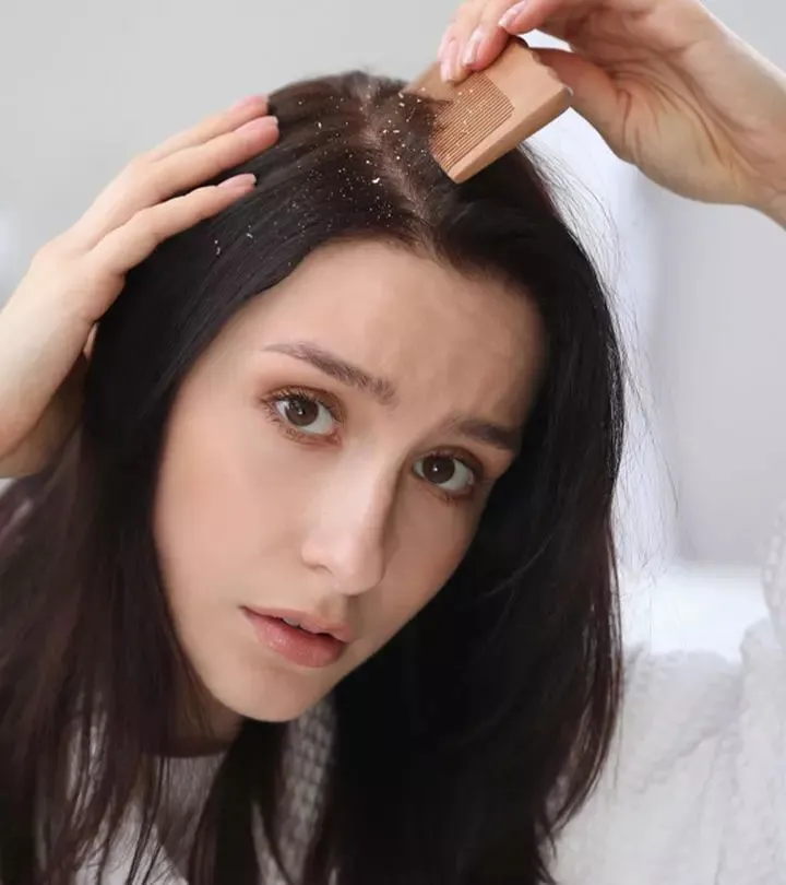 Daily Hair Care Routine to Prevent Dandruff