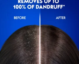 Top Shampoos for Dandruff-Free Healthy Hair